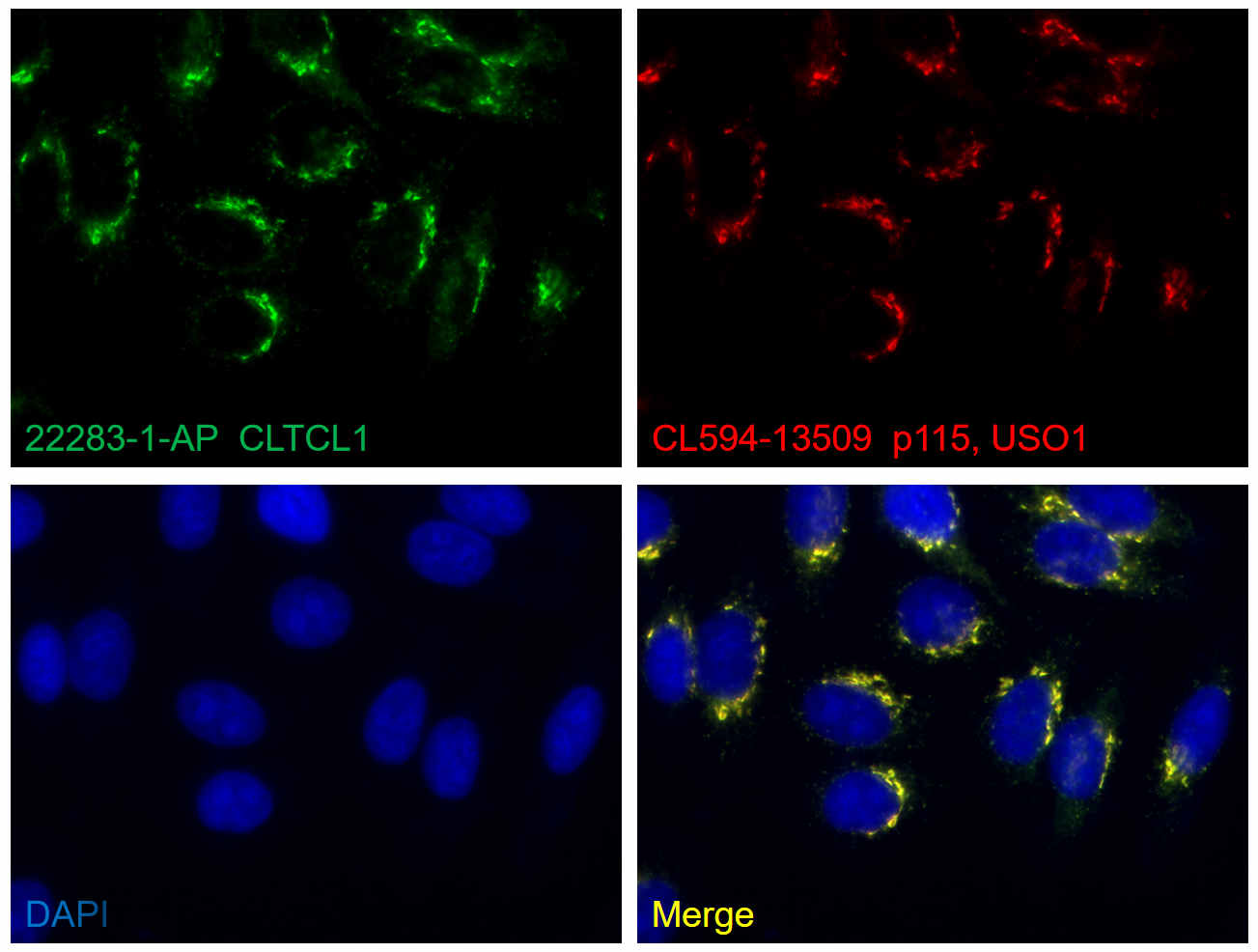 Immunofluorescence (IF) / fluorescent staining of HepG2 cells using CLTCL1 Polyclonal antibody (22283-1-AP)