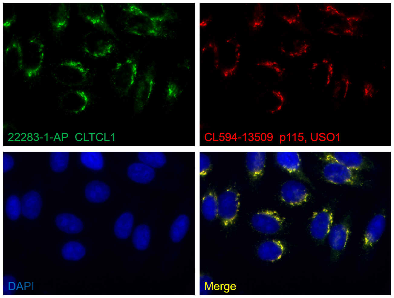 IF Staining of HepG2 using 22283-1-AP