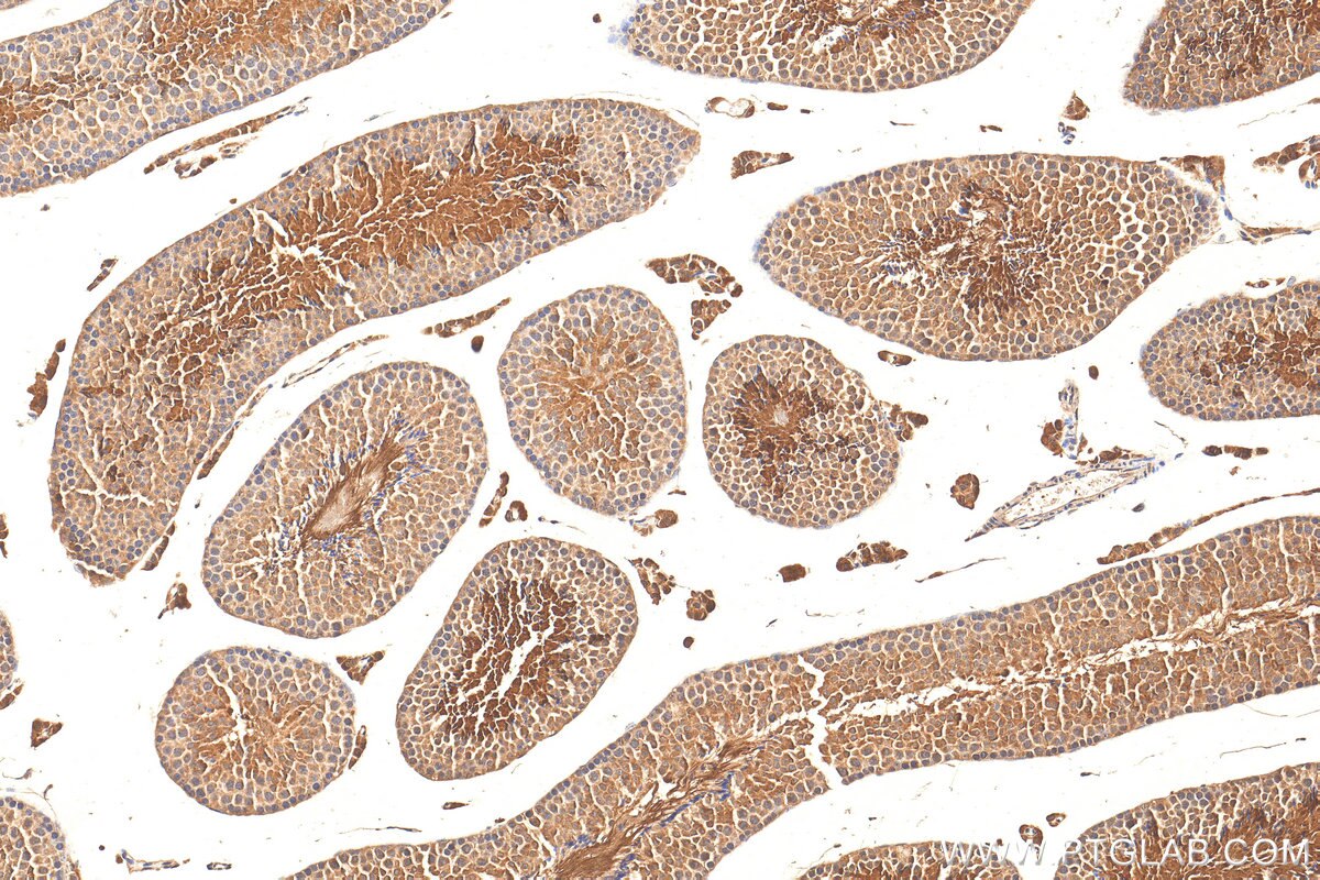 Immunohistochemistry (IHC) staining of mouse testis tissue using CLTCL1 Polyclonal antibody (22283-1-AP)
