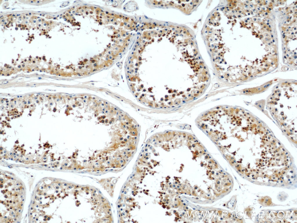 Immunohistochemistry (IHC) staining of human testis tissue using CLTCL1 Polyclonal antibody (22283-1-AP)