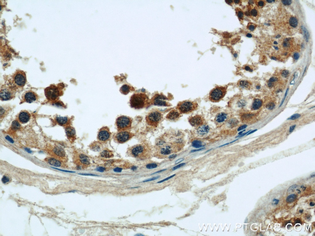 Immunohistochemistry (IHC) staining of human testis tissue using CLTCL1 Polyclonal antibody (22283-1-AP)