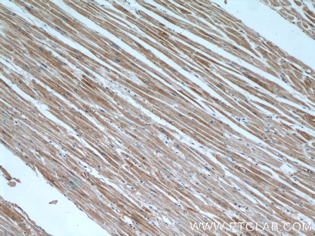 IHC staining of human heart using 22283-1-AP