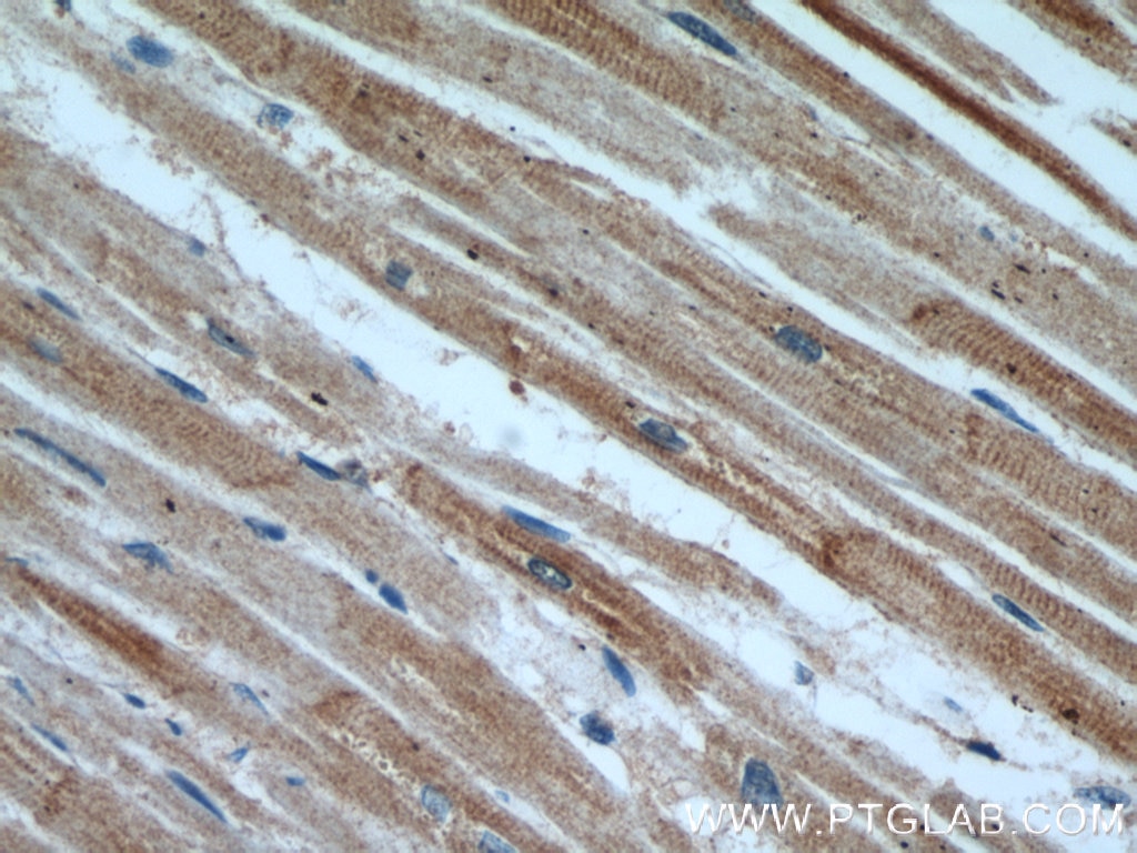 Immunohistochemistry (IHC) staining of human heart tissue using CLTCL1 Polyclonal antibody (22283-1-AP)