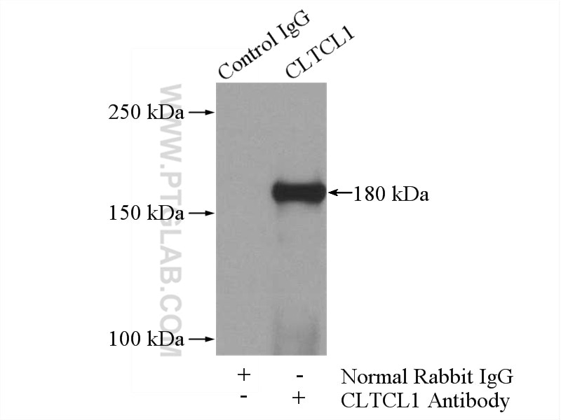 Immunoprecipitation (IP) experiment of HeLa cells using CLTCL1 Polyclonal antibody (22283-1-AP)