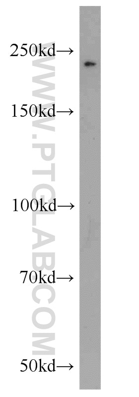 Western Blot (WB) analysis of Jurkat cells using CLTCL1 Polyclonal antibody (22283-1-AP)