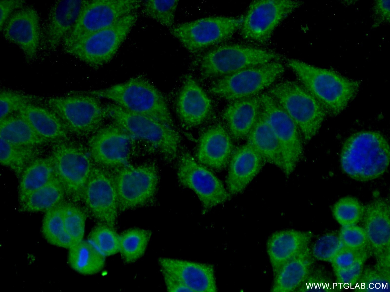 Immunofluorescence (IF) / fluorescent staining of HeLa cells using CLTCL1 Monoclonal antibody (66274-1-Ig)