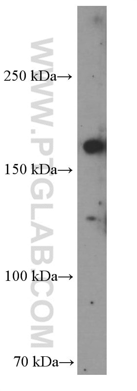 Western Blot (WB) analysis of HEK-293 cells using CLTCL1 Monoclonal antibody (66274-1-Ig)