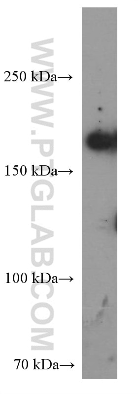 Western Blot (WB) analysis of Jurkat cells using CLTCL1 Monoclonal antibody (66274-1-Ig)