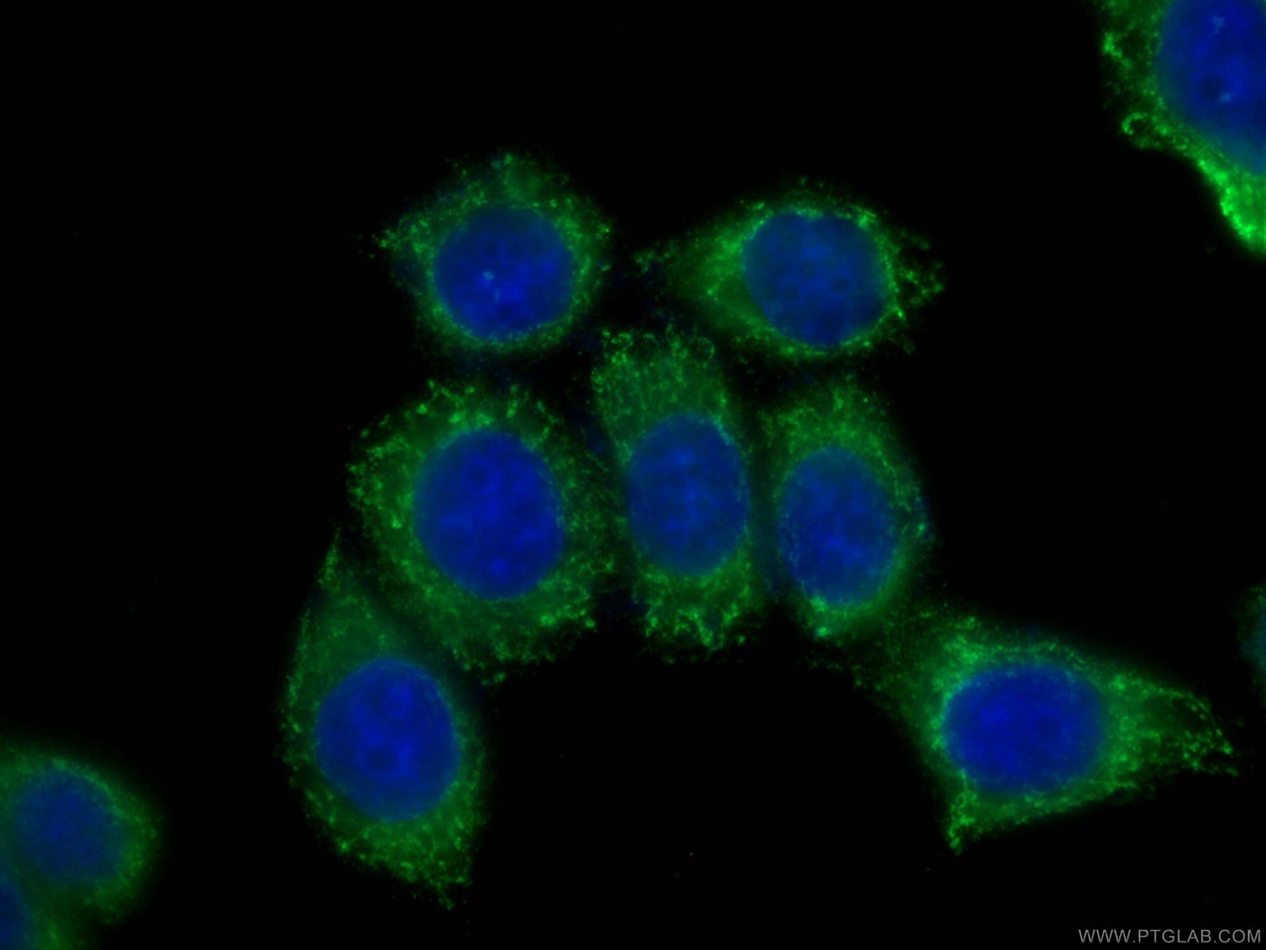 Immunofluorescence (IF) / fluorescent staining of HeLa cells using CoraLite® Plus 488-conjugated CLTCL1 Monoclonal an (CL488-66274)