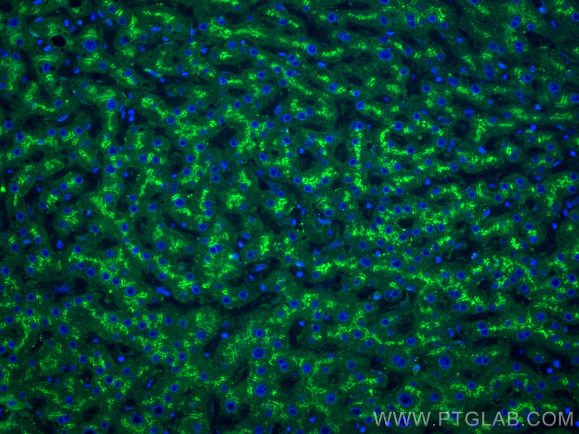 Immunofluorescence (IF) / fluorescent staining of human liver tissue using Clusterin Polyclonal antibody (12289-1-AP)