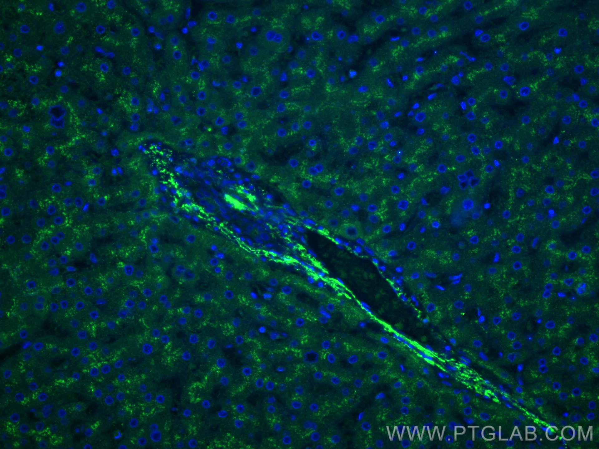 Immunofluorescence (IF) / fluorescent staining of human liver tissue using Clusterin Polyclonal antibody (12289-1-AP)