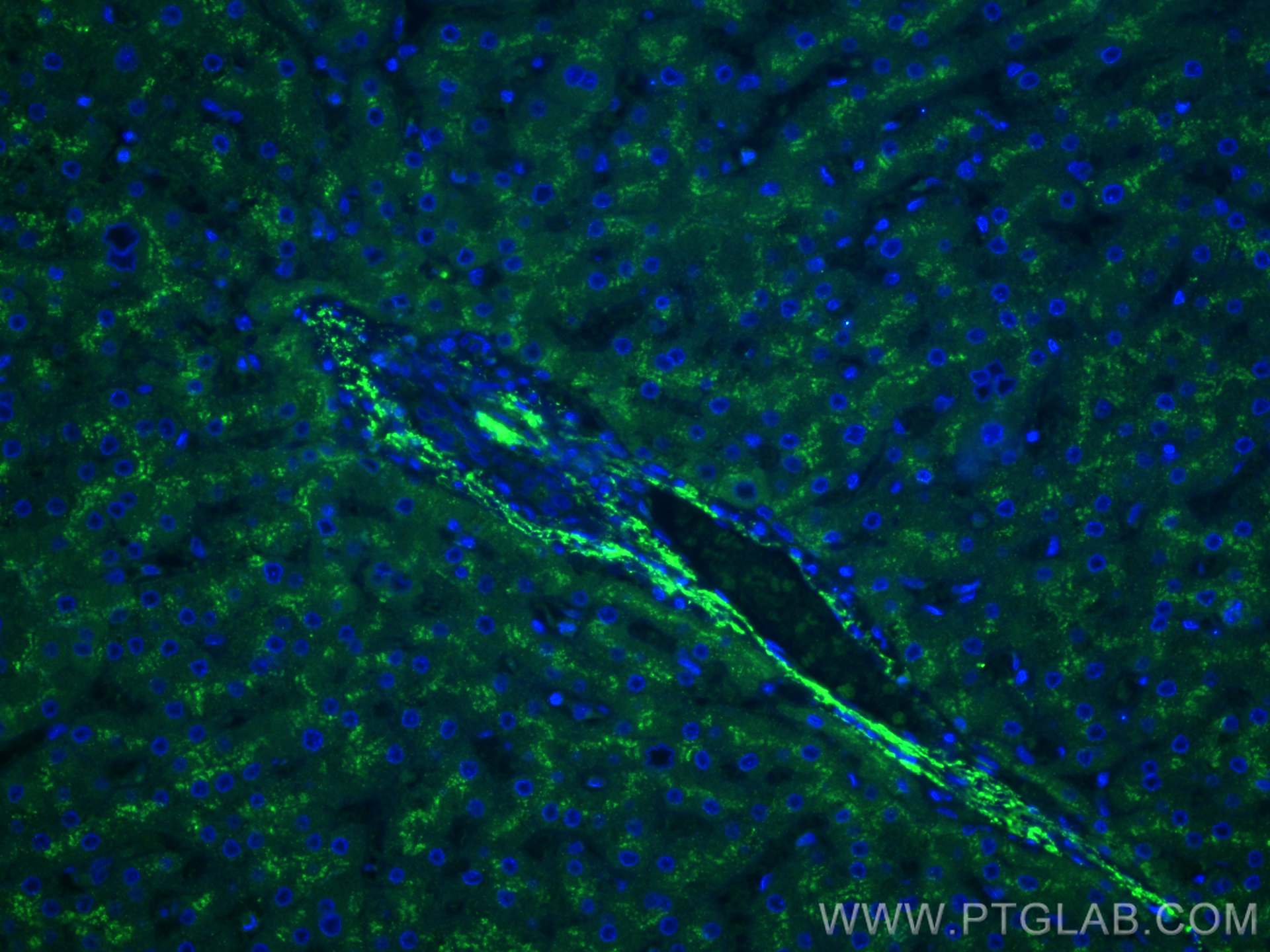 IF Staining of human liver using 12289-1-AP