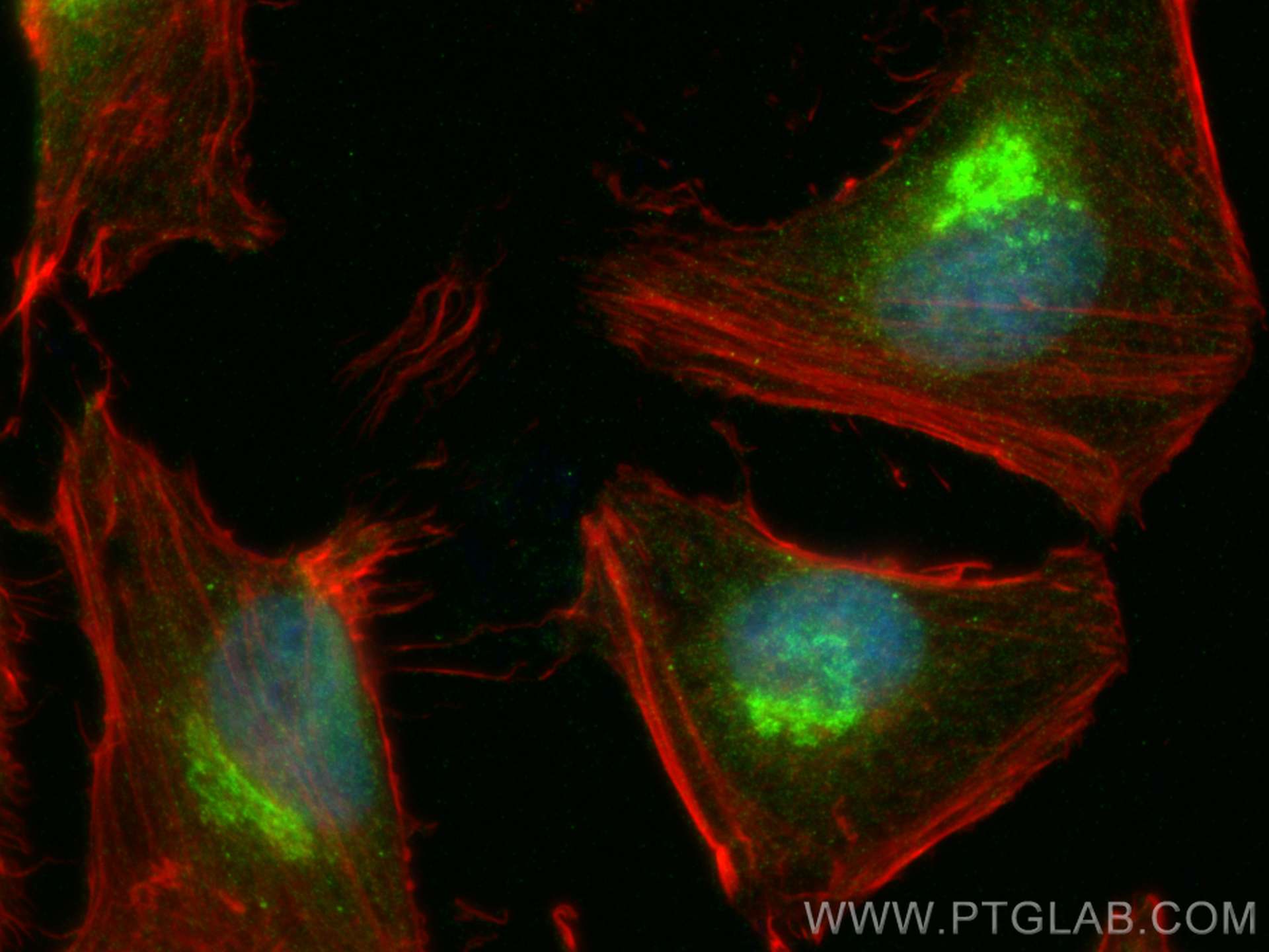 Immunofluorescence (IF) / fluorescent staining of HeLa cells using Clusterin Polyclonal antibody (12289-1-AP)
