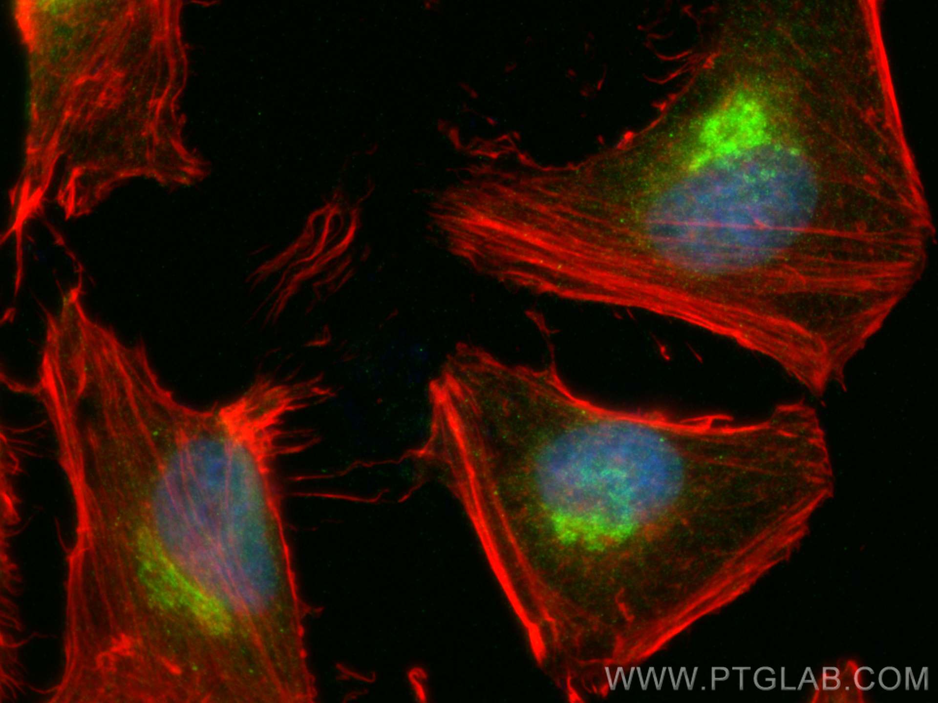 IF Staining of HeLa using 12289-1-AP