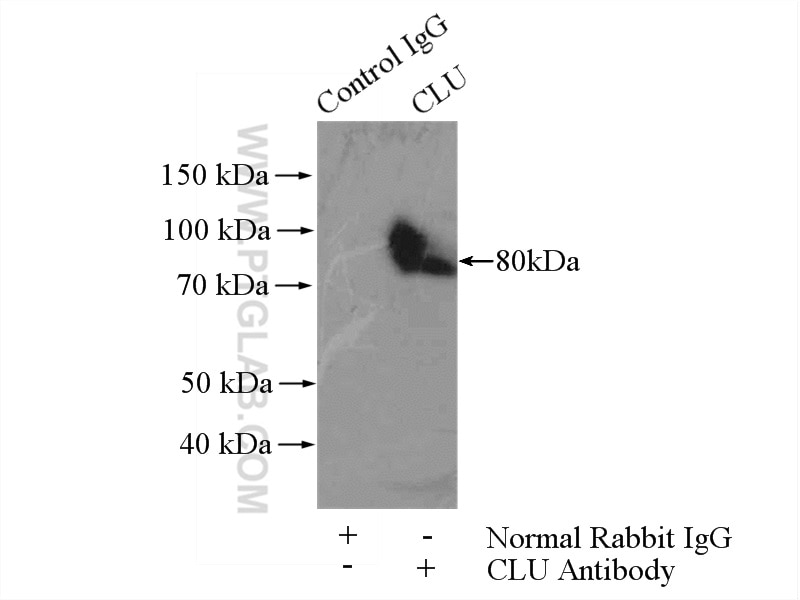 Clusterin Polyclonal antibody