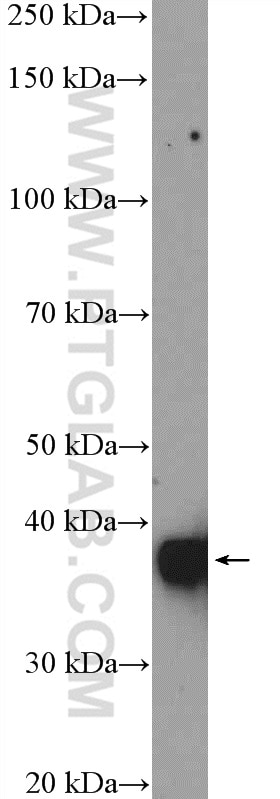 WB analysis of human plasma using 12289-1-AP