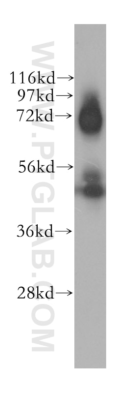 Clusterin Polyclonal antibody