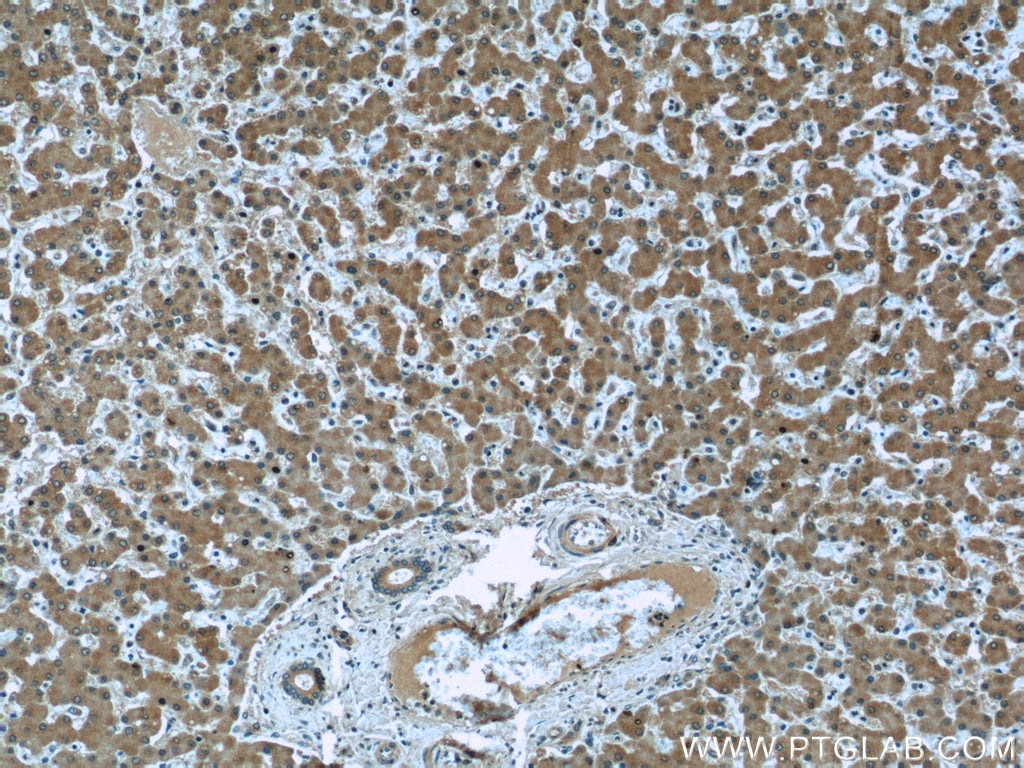 Immunohistochemistry (IHC) staining of human liver tissue using Clusterin Monoclonal antibody (66109-1-Ig)
