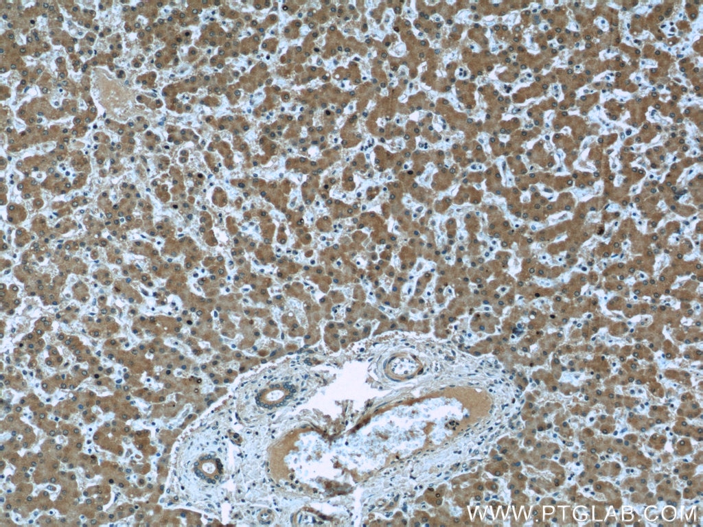 IHC staining of human liver using 66109-1-Ig