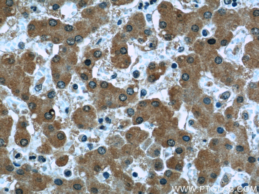 Immunohistochemistry (IHC) staining of human liver tissue using Clusterin Monoclonal antibody (66109-1-Ig)