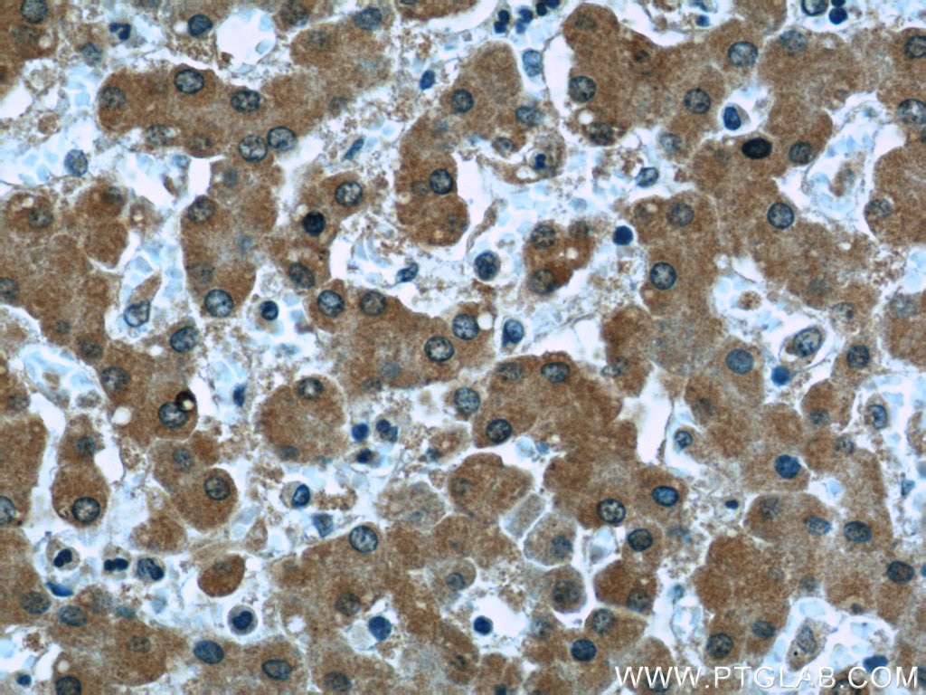 Clusterin Monoclonal antibody