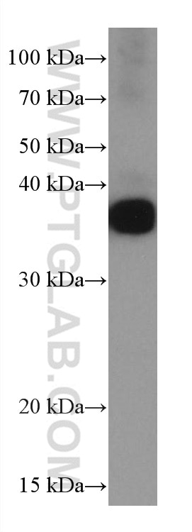 WB analysis of human plasma using 66109-1-Ig