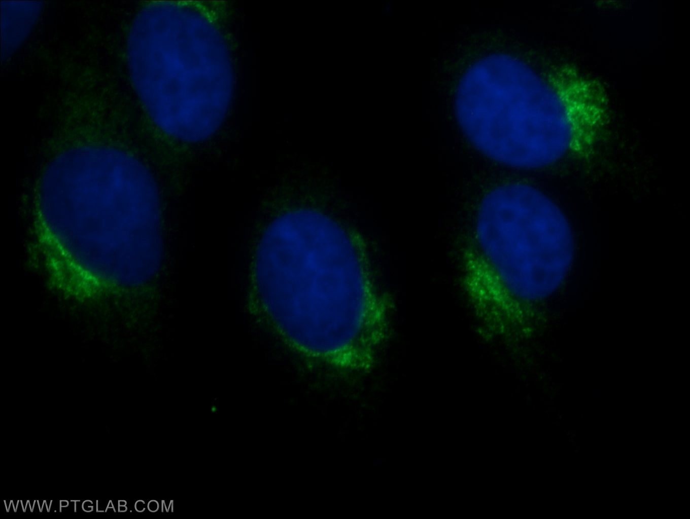 Immunofluorescence (IF) / fluorescent staining of MDCK cells using CLUAP1 Polyclonal antibody (17470-1-AP)