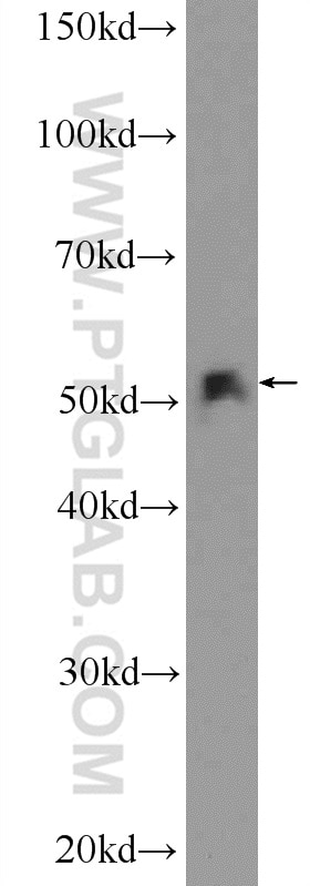 WB analysis of HepG2 using 17470-1-AP