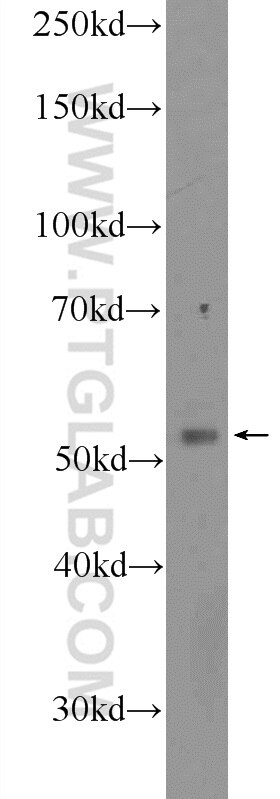 Western Blot (WB) analysis of COLO 320 cells using CLUAP1 Polyclonal antibody (17470-1-AP)