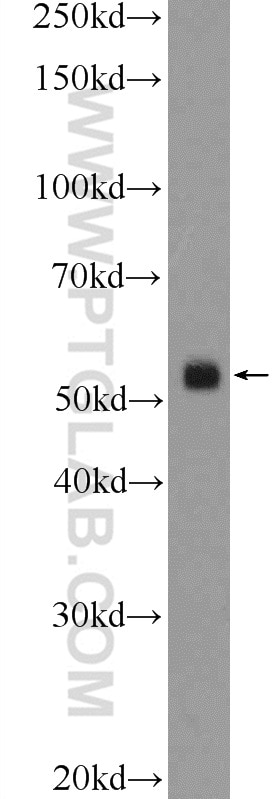 WB analysis of mouse testis using 17470-1-AP