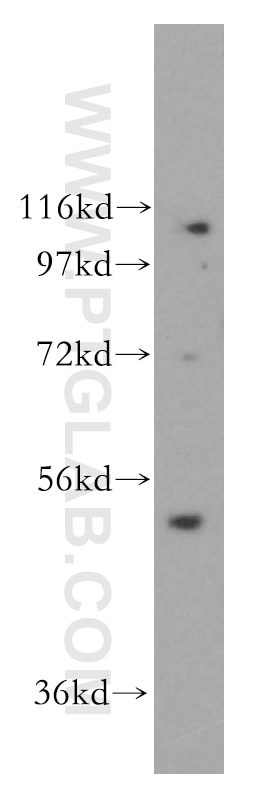 Western Blot (WB) analysis of HepG2 cells using CLUAP1 Polyclonal antibody (17470-1-AP)