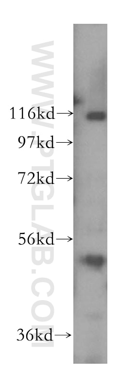 Western Blot (WB) analysis of Y79 cells using CLUAP1 Polyclonal antibody (17470-1-AP)