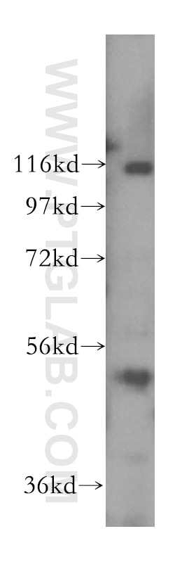 WB analysis of Y79 using 17470-1-AP