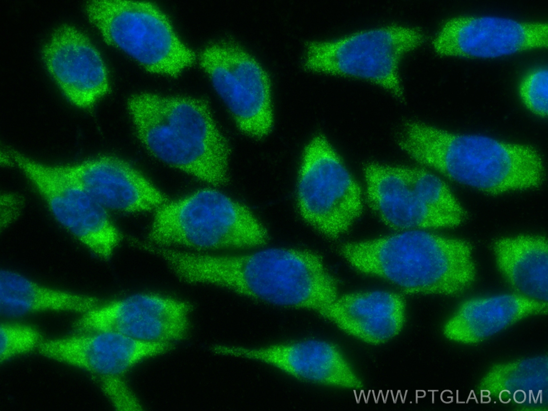 Immunofluorescence (IF) / fluorescent staining of COS-7 cells using CLUH Polyclonal antibody (30986-1-AP)