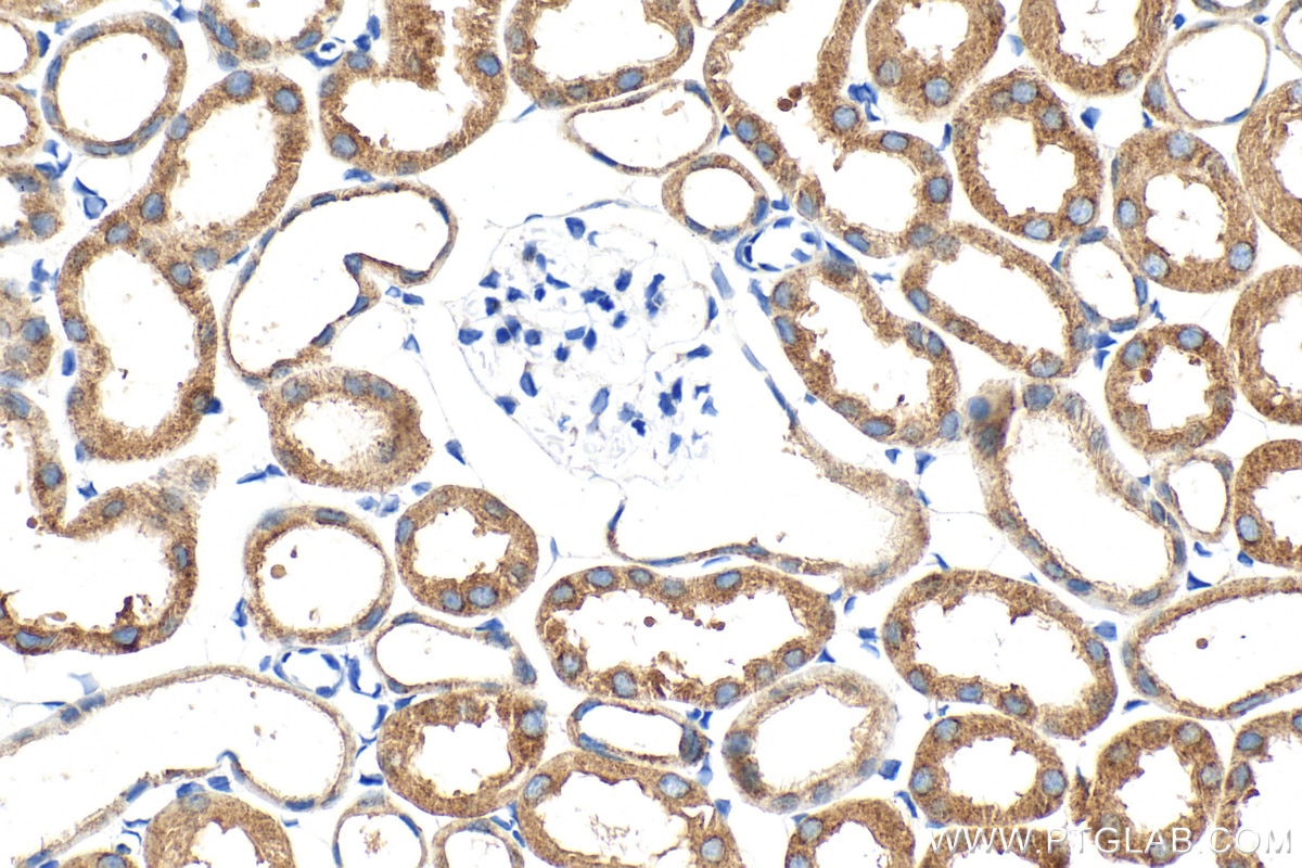 Immunohistochemical analysis of paraffin-embedded mouse kidney tissue slide using 30986-1-AP (CLUH antibody) at dilution of 1:500 (under 40x lens). Heat mediated antigen retrieval with Tris-EDTA buffer (pH 9.0). Immunohistochemistry (IHC) staining of mouse kidney tissue using CLUH Polyclonal antibody (30986-1-AP)