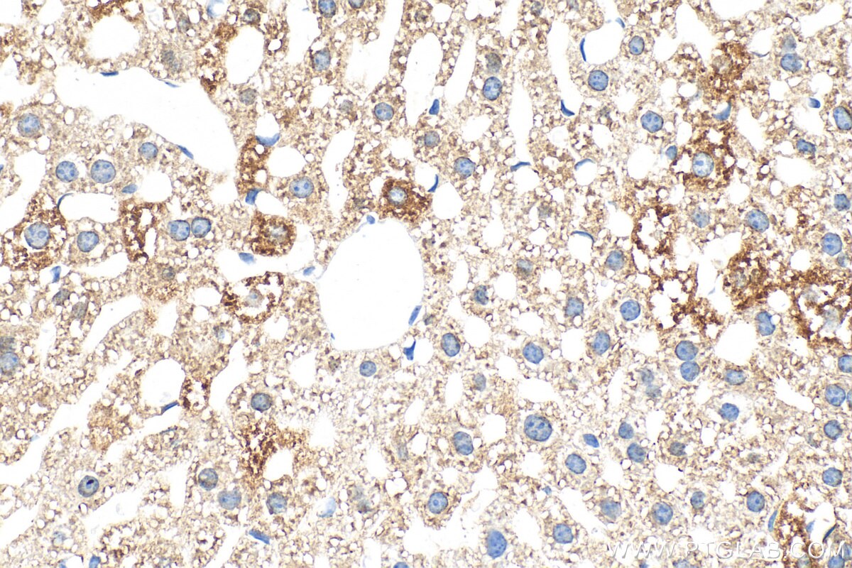 Immunohistochemical analysis of paraffin-embedded mouse liver tissue slide using 30986-1-AP (CLUH antibody) at dilution of 1:500 (under 40x lens). Heat mediated antigen retrieval with Tris-EDTA buffer (pH 9.0). Immunohistochemistry (IHC) staining of mouse liver tissue using CLUH Polyclonal antibody (30986-1-AP)