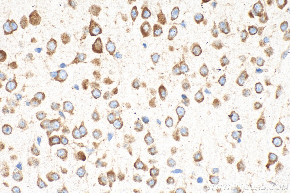 Immunohistochemical analysis of paraffin-embedded mouse brain tissue slide using 30986-1-AP (CLUH antibody) at dilution of 1:500 (under 40x lens). Heat mediated antigen retrieval with Tris-EDTA buffer (pH 9.0). Immunohistochemistry (IHC) staining of mouse brain tissue using CLUH Polyclonal antibody (30986-1-AP)
