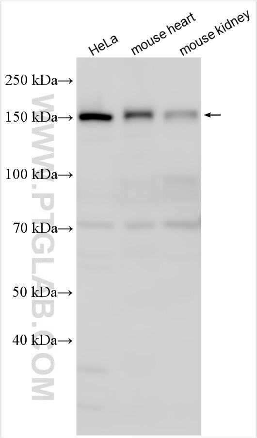 Western Blot (WB) analysis of various lysates using CLUH Polyclonal antibody (30986-1-AP)