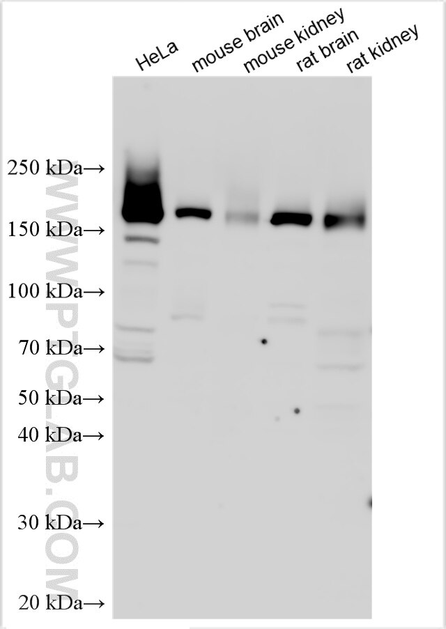 Western Blot (WB) analysis of various lysates using CLUH Polyclonal antibody (30986-1-AP)