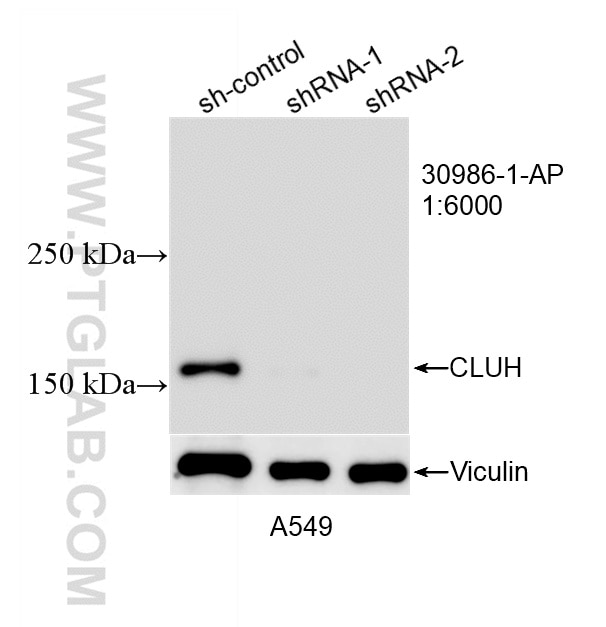 WB analysis of A549 using 30986-1-AP Western Blot (WB) analysis of A549 cells using CLUH Polyclonal antibody (30986-1-AP)