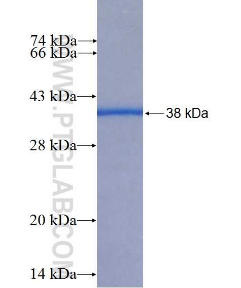 CLUL1 fusion protein Ag26570 SDS-PAGE