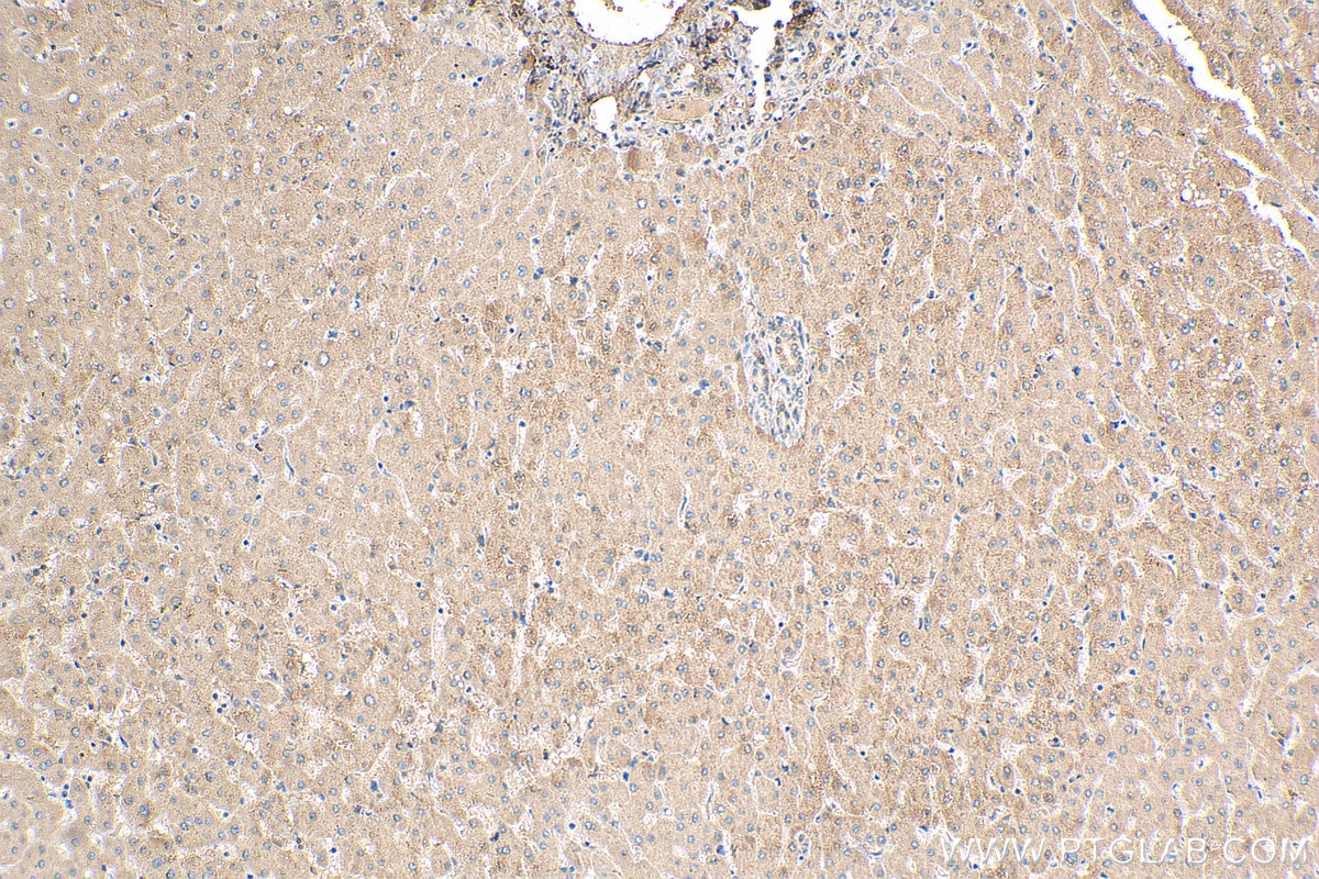Immunohistochemistry (IHC) staining of human liver tissue using CLYBL Polyclonal antibody (17314-1-AP)