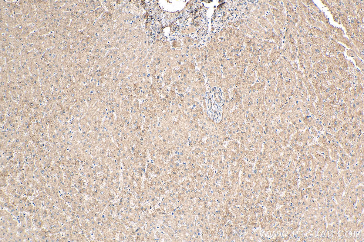Immunohistochemistry (IHC) staining of human liver tissue using CLYBL Polyclonal antibody (17314-1-AP)