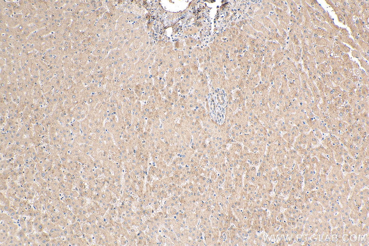 IHC staining of human liver using 17314-1-AP