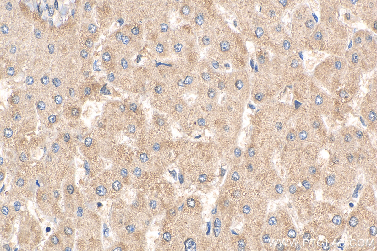 Immunohistochemistry (IHC) staining of human liver tissue using CLYBL Polyclonal antibody (17314-1-AP)