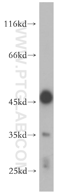 Western Blot (WB) analysis of HepG2 cells using CLYBL Polyclonal antibody (17314-1-AP)