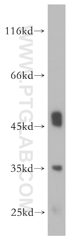 Western Blot (WB) analysis of human heart tissue using CLYBL Polyclonal antibody (17314-1-AP)