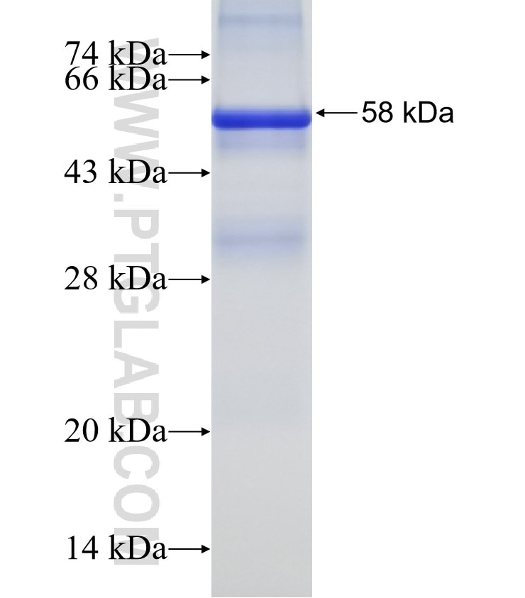 CLYBL fusion protein Ag11283 SDS-PAGE