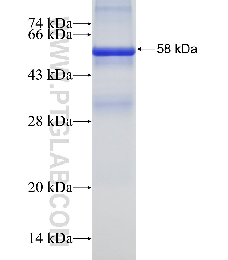 CLYBL fusion protein Ag11283 SDS-PAGE