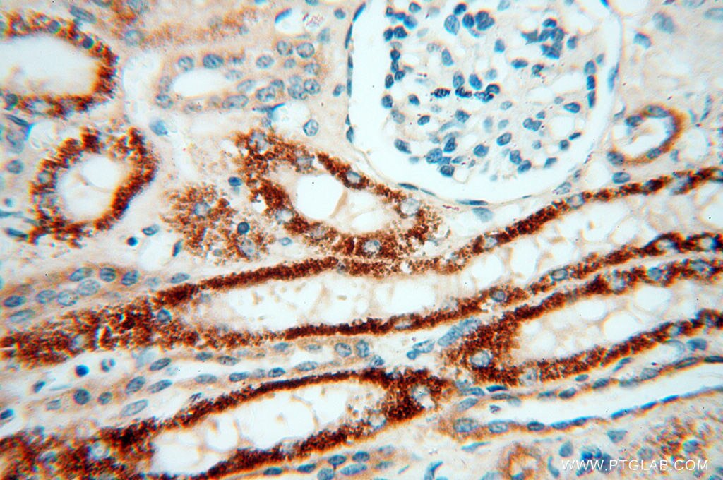 Mast Cell Chymase